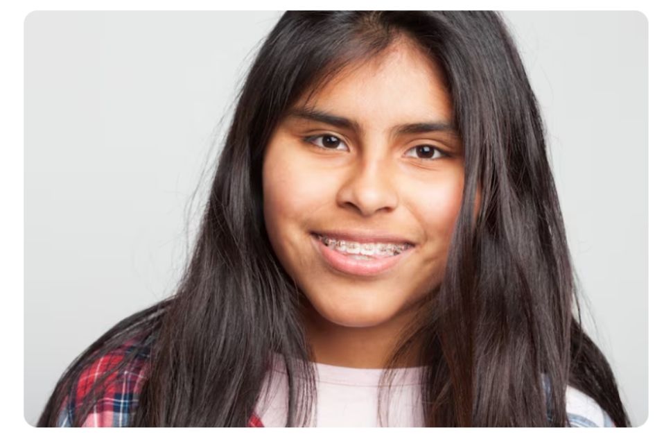 low cost braces in mumbai 